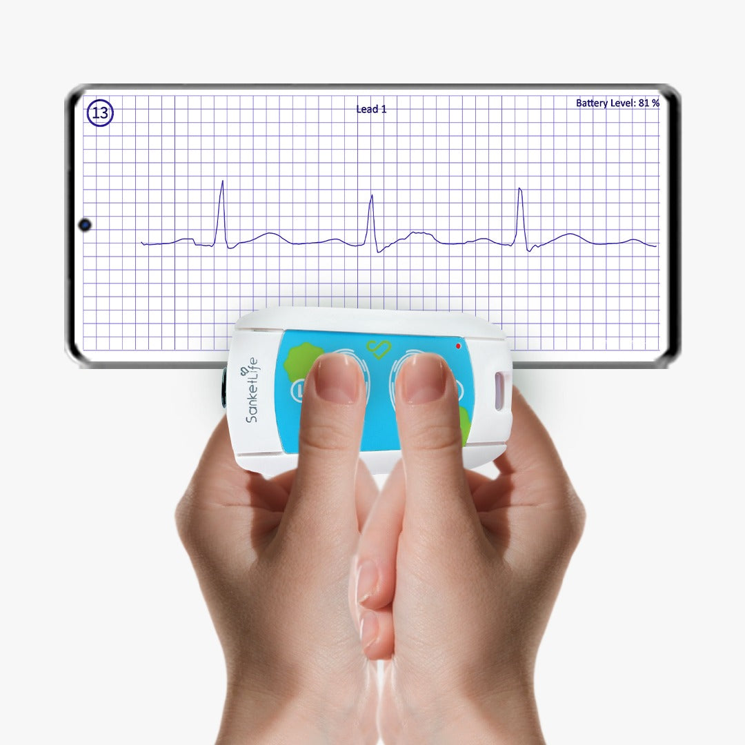Sanketlife 2.0  | Portable ECG Machine